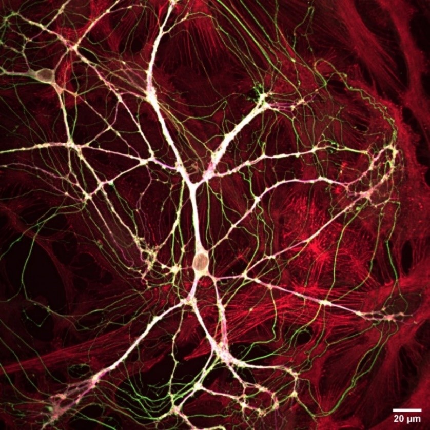 染色的共培养的神经元细胞.jpg