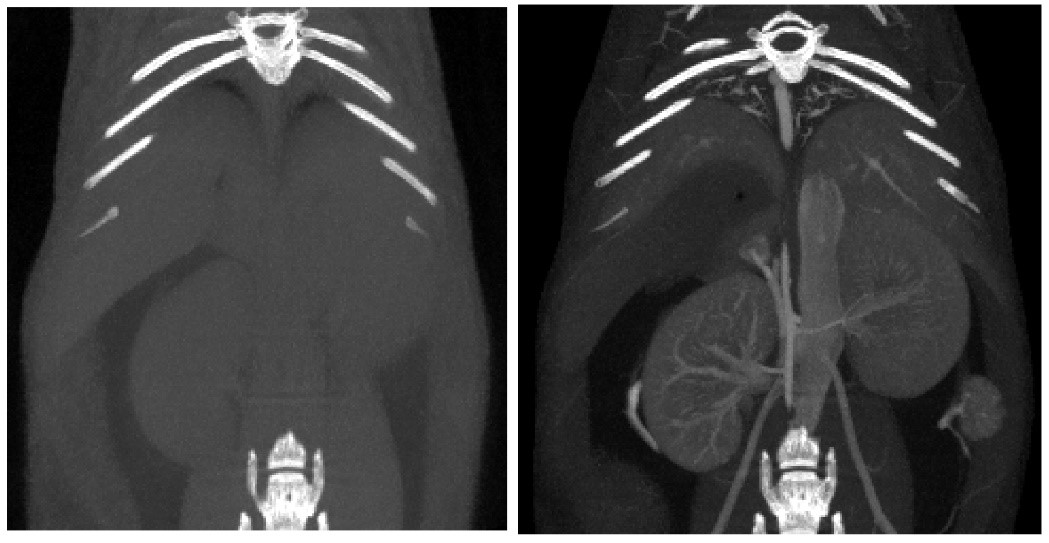 对比增强CT.jpg