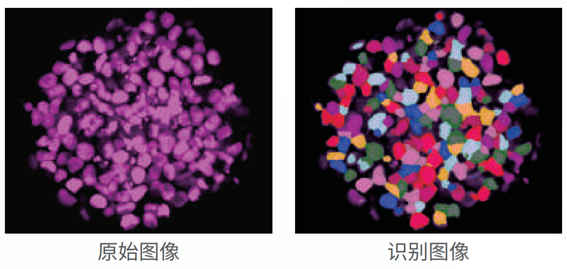 应用3：类器官、球体成像.png