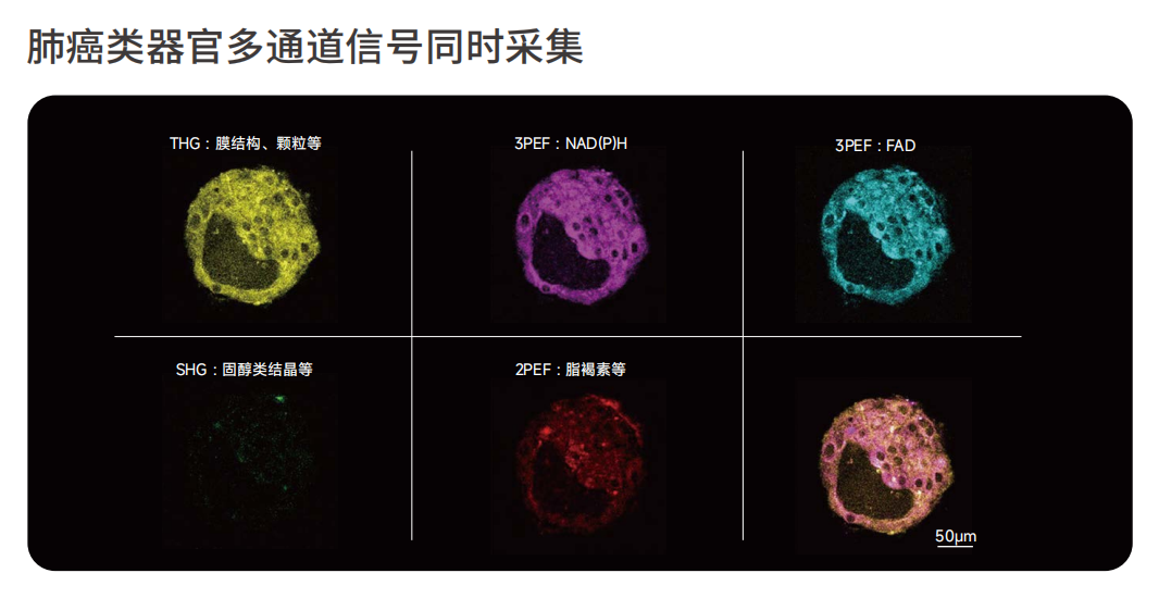 肺癌类器官多通道信号同时采集.png